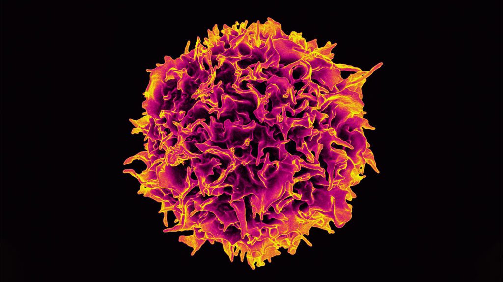 Science NewsA newly approved ‘living drug’ could save more cancer patients’ livesTumor-infiltrating lymphocyte, or TIL, therapy is the first T cell 
treatment for solid tumors. It fights melanoma and maybe other cancers….1 week ago 082424 Til Cover.jpg
