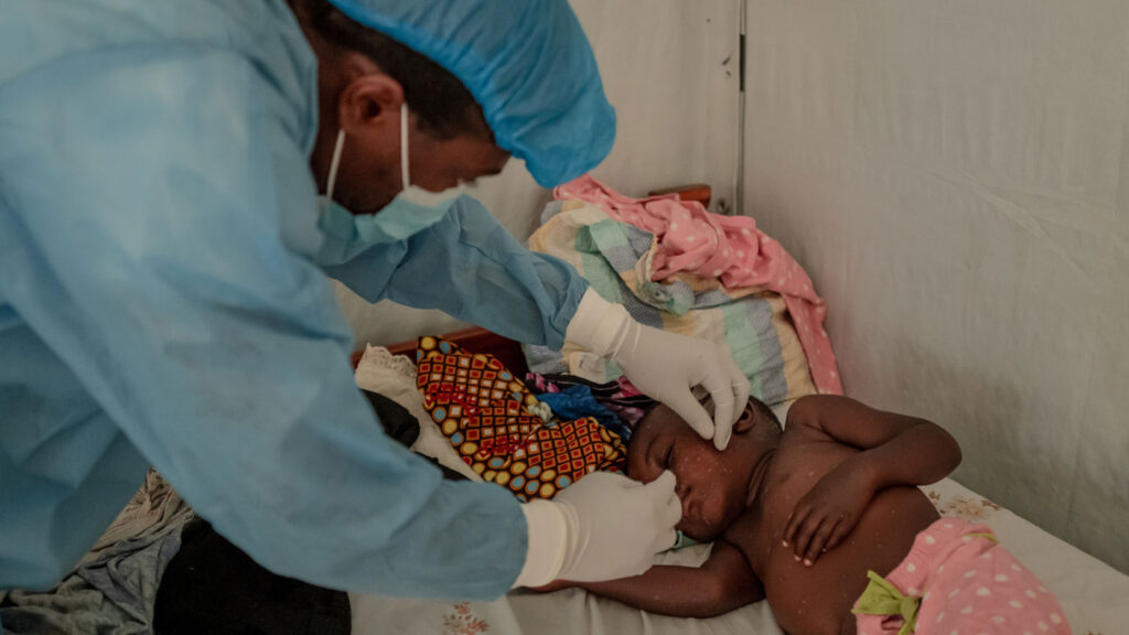 Even as vaccines for mpox reach Africa, questions remain about the virus 090324 Eg Mpox Feat Rev.jpg