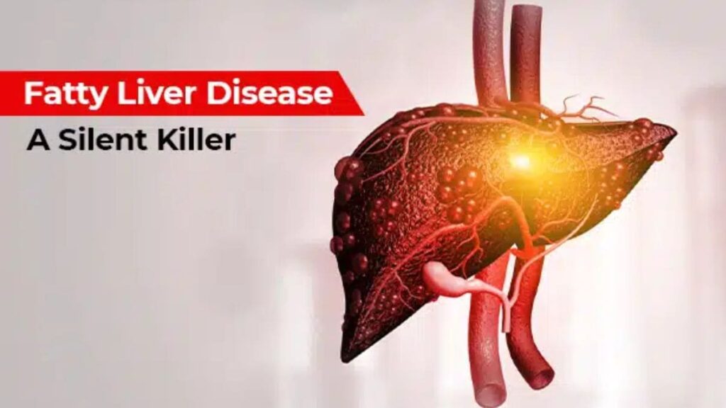 How lifestyle choices & genetics drive alarming surge in fatty liver disease – Firstpost Frankfurt Airport Halts Flights As Climate Activists Block Runway 67 2024 09 Ac294adec76db0f597e1e86.jpeg
