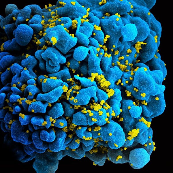 Science news in review: Sept. 8 Eb051f9d 0df0 4905 Ae54 A432ee6ca453.sized 1000x1000.jpg
