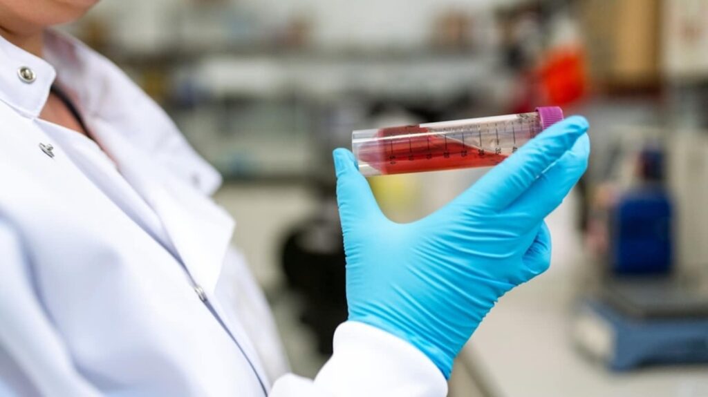 Dye found in Doritos turns mouse’s skin transparent like ‘magic trick’, new study finds Photo 1581091018783 A79a8863e4d6 1725808226762 1725808252245.jpg