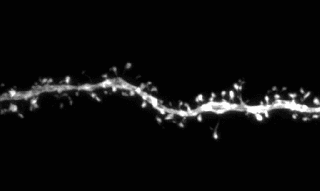 Scientists discover unexpected link between genes involved in human brain evolution and developmental disorders Scientists20discover20unexpected20link20between20genes20involved20in20human20brain20evolut.png