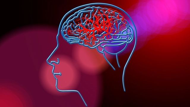 Stroke Prevention: New Guidelines for Risk Factor Screening Stroke Prevention New Guidelines For Risk Factor Screening And Lifestyle Modification 392335 640x360.jpeg