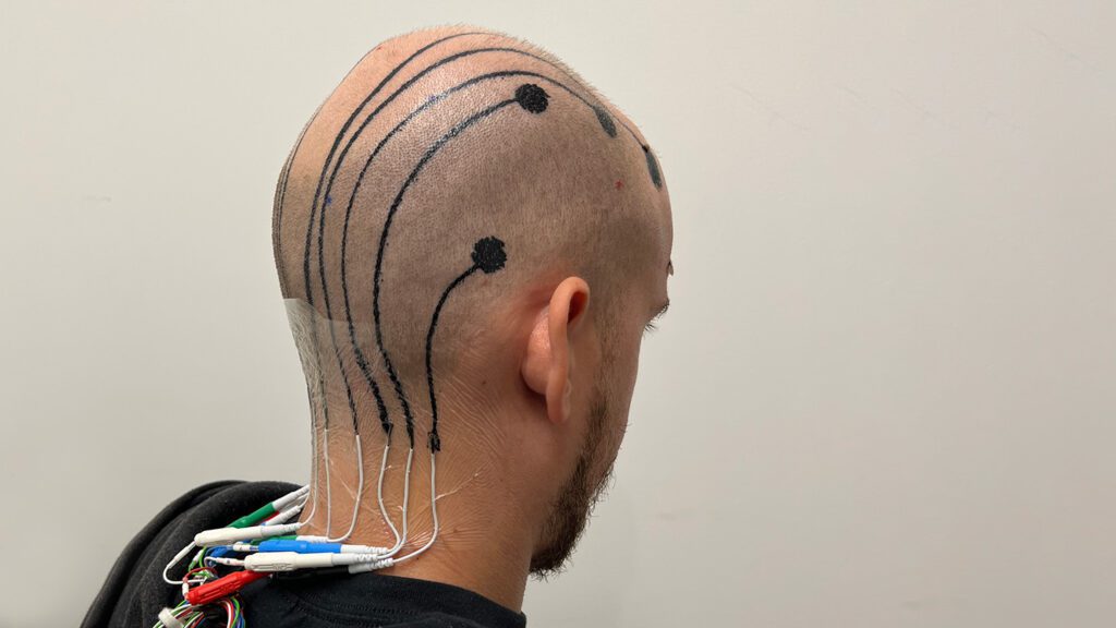 112624 Ls Eeg Tattoo Feat.jpg