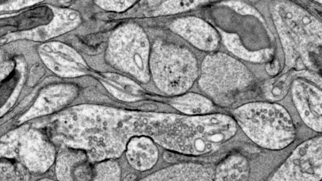 The message-sending part of neurons may be blobby, not smooth 121024 Ls Axons Feat.jpg