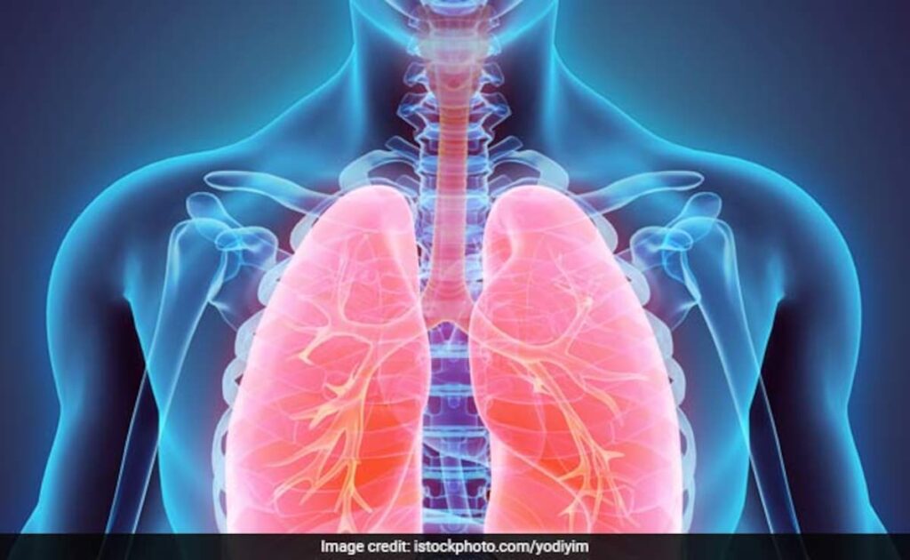 These Lifestyle Changes Can Improve Your Lung Health 74f42r2o Copd 625x300 21 November 18.jpg