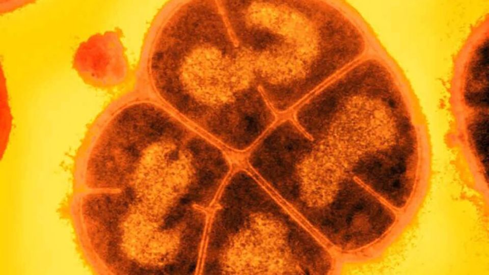 ‘Conan the Bacterium’ can withstand radiation that could kill a human. Scientists say they’ve found its secret weapon Baedb4874018b705fc673c3a08cfe336.jpeg