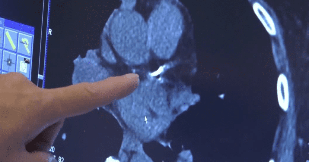 Inversions can make health issues even worse, study shows Urlhttps3a2f2fx Default Stgec.uplynk.com2fause2fslices2f43a2fef205c0e5ea14d77944cbd69043351.png