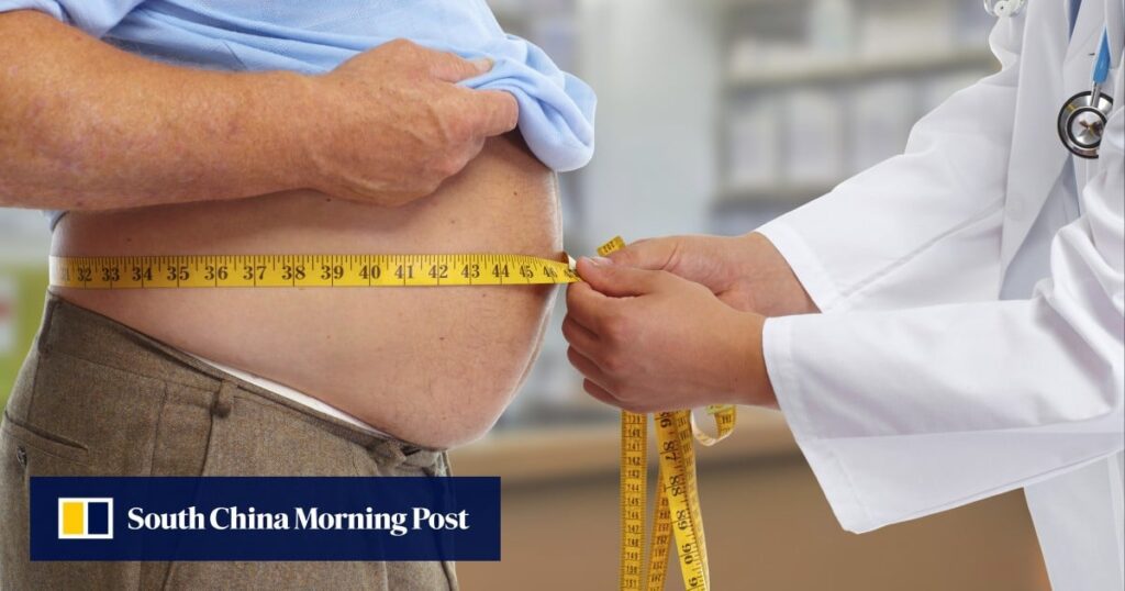 How to prevent fatty liver disease, a silent killer, with minor lifestyle changes 69075030 D4be 4d01 87c4 2e3ba5c7a53a 0ab6d6c9.jpg