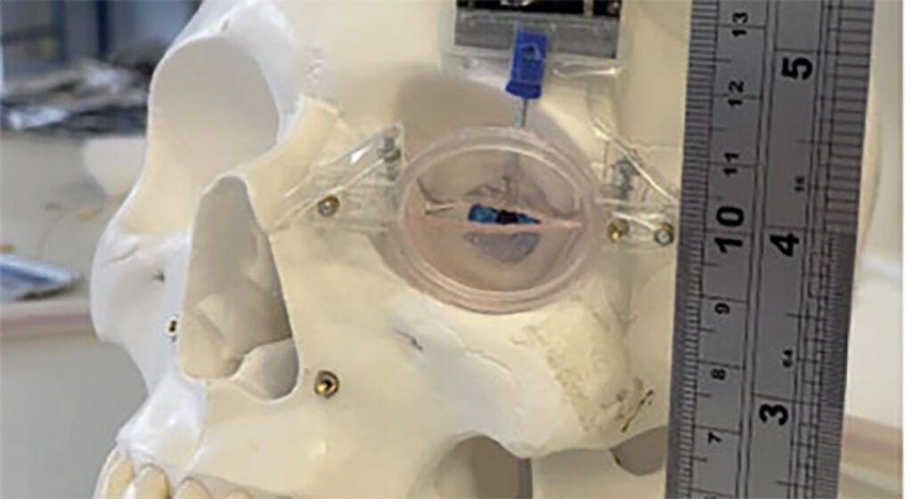 Artificial muscle could help facial paralysis sufferers blink again Screenshot 2025 02 25 130519.jpg