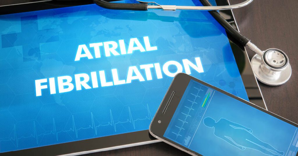 Atrial fibrillation tablet adobestock.jpg