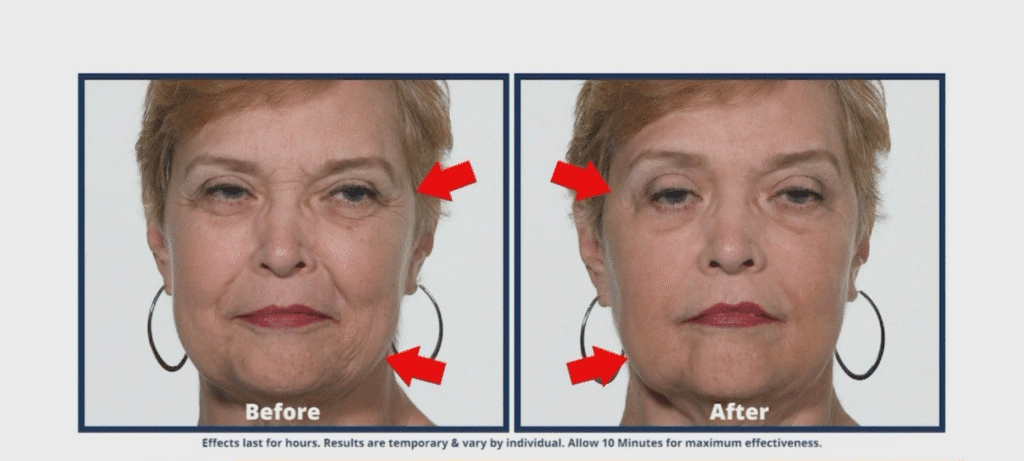 1208 plexaderm 2.png