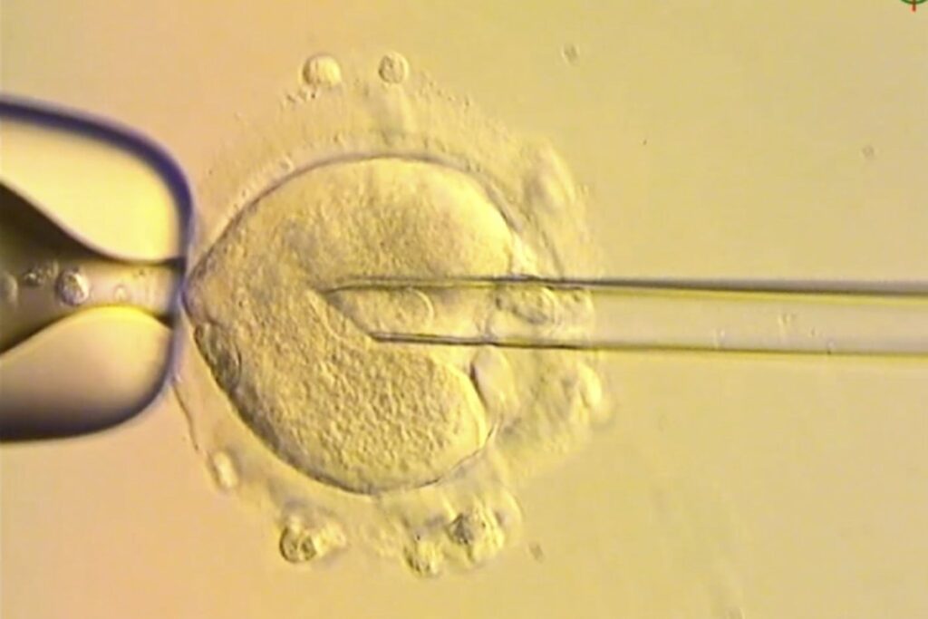 Healthy babies born in Britain after scientists used DNA from three people to avoid genetic disease D68b11271a0809a08e4040a775e9aaaacceb6d035aa7cf2d7b4f2c29b2e248e4.jpgw1200h800modecrop.jpeg