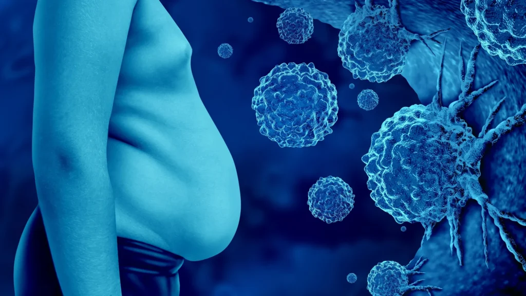 Obesity belly cancer cells.webp.webp