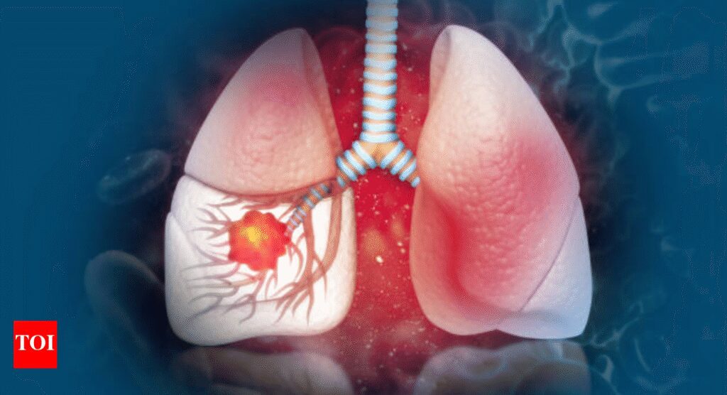 Lifestyle and lung cancer link: How daily choices raise or lower your risk | 1754160210 photo.jpg