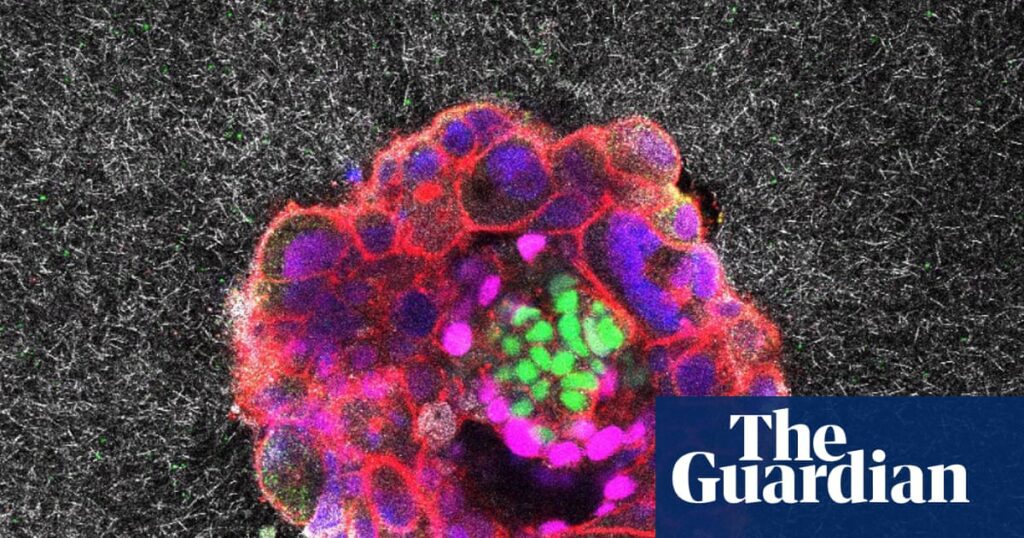 Scientists capture first footage of human embryo implanting in a uterus | Science 822.jpg