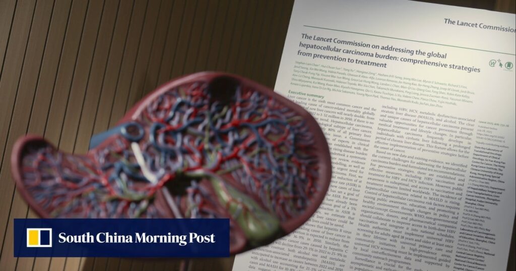 Lifestyle fixes can curb doubling of liver cancer cases by 2050: Hong Kong experts D0d1bcd1 a7be 4c18 815d 281b5605f217 c38cd9bb.jpg