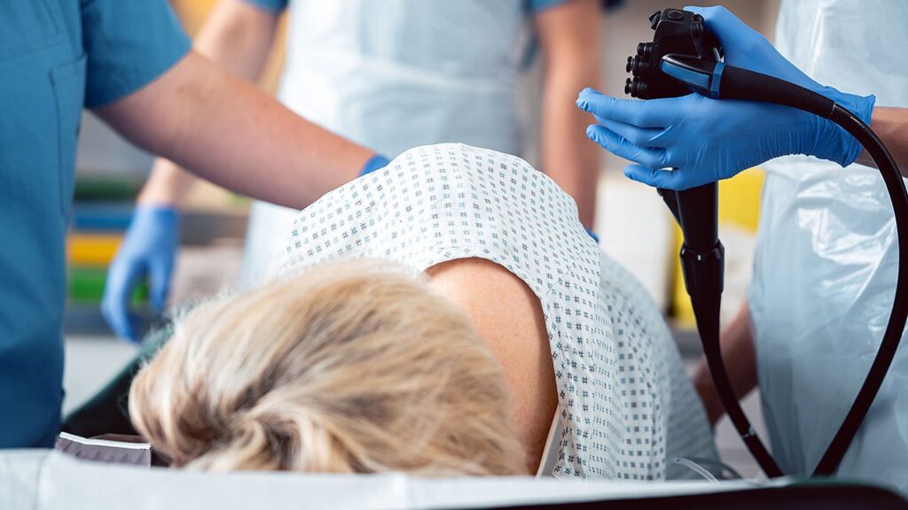 Lifestyle Changes After Colonoscopy May Lower CRC Risk Dt 250806 colonoscopy 800x450.jpg