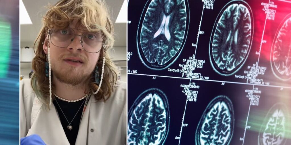 Nearly half of cases can be avoided through 14 lifestyle changes Toby curless brain scans.jpg