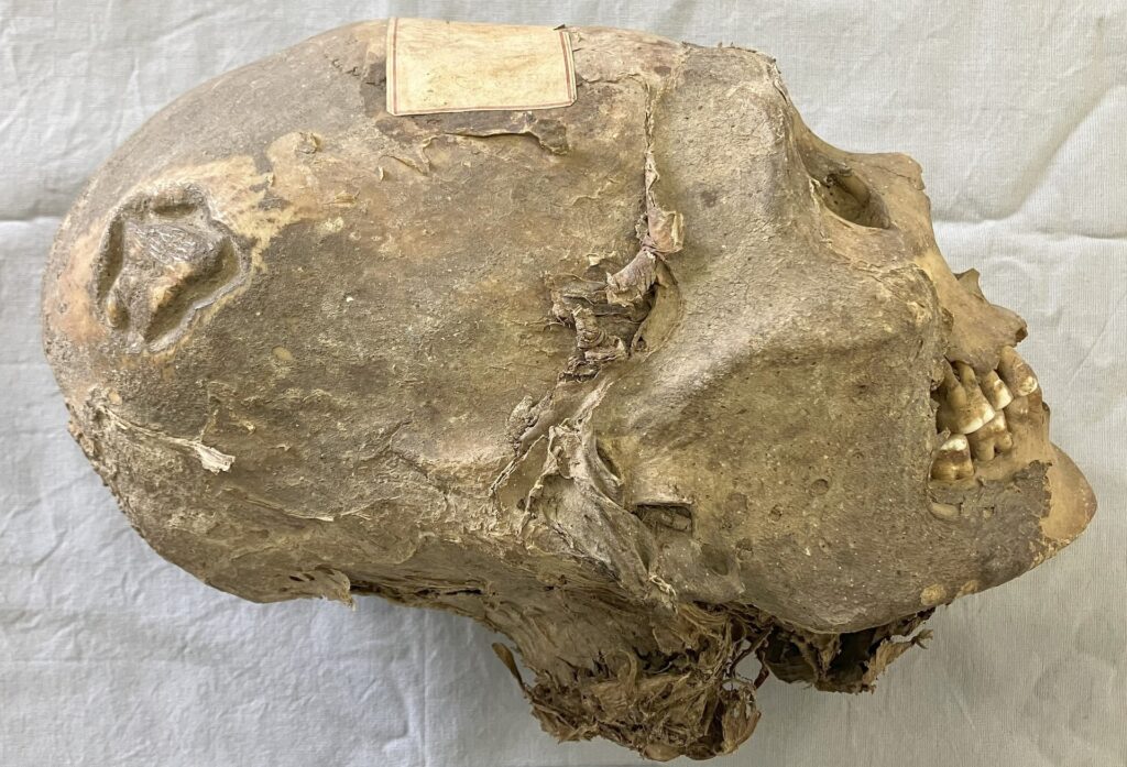 350-year-old mummified head from Bolivia isn’t what it seems N87fqjsrvuaw4rancns2xp.jpg