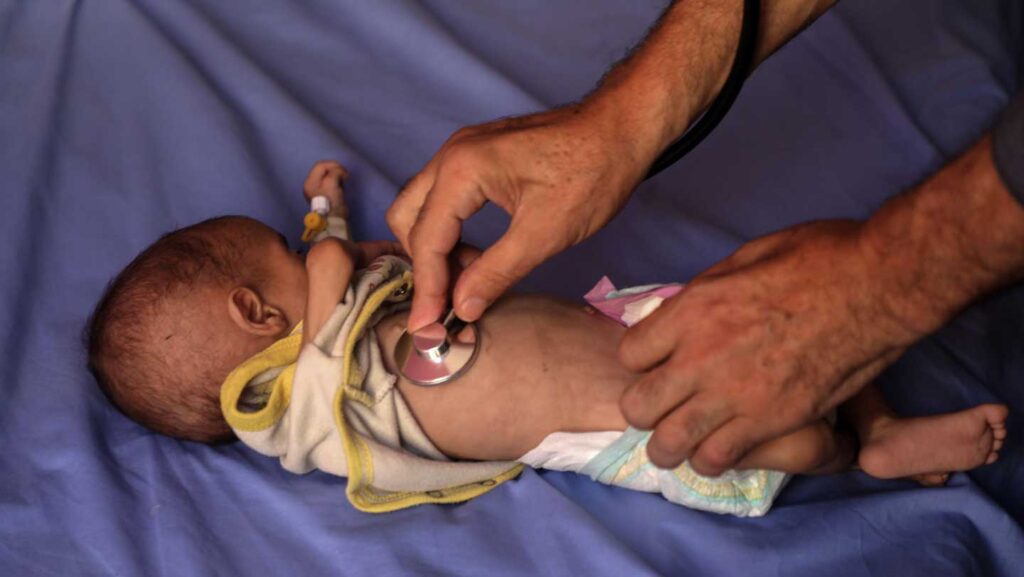 101425 ac malnutrition.jpg