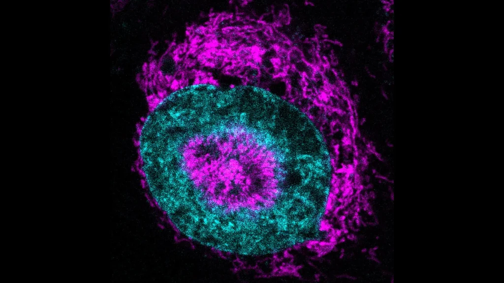 Confined cancer cells.webp.webp