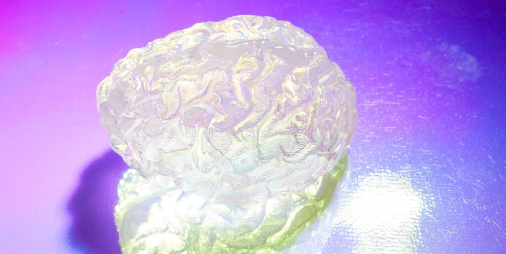 How Obesity Could Fuel Alzheimer’s Risk, Per A New Study Whl brain 178 preview 68e4265dbf9b7.jpeg